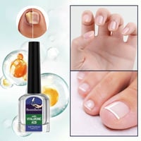 Lösning för svampdödande nagelreparation
