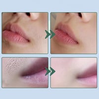 Crème hydratante réparatrice pour l'épilation