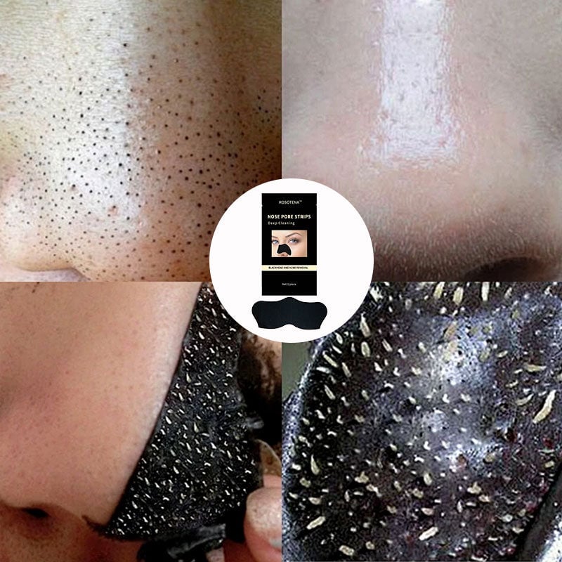 Deep-Cleansing Blackhead Nose Strips