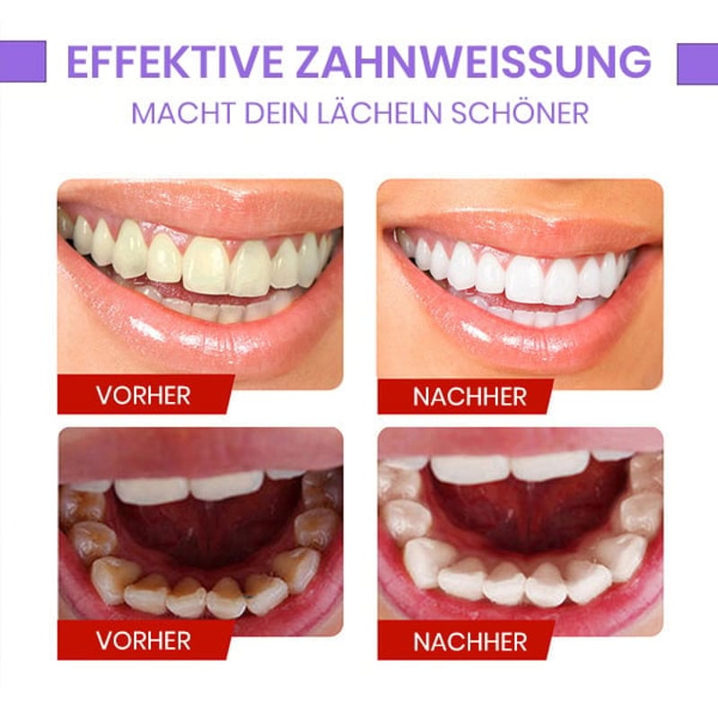 Zahnfarbkorrektur