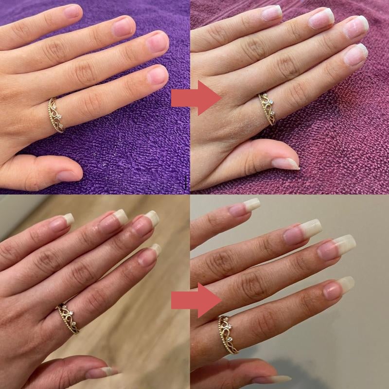 💅Hot Sale 49%OFF🔥Nails Nutritious Growth Oil
