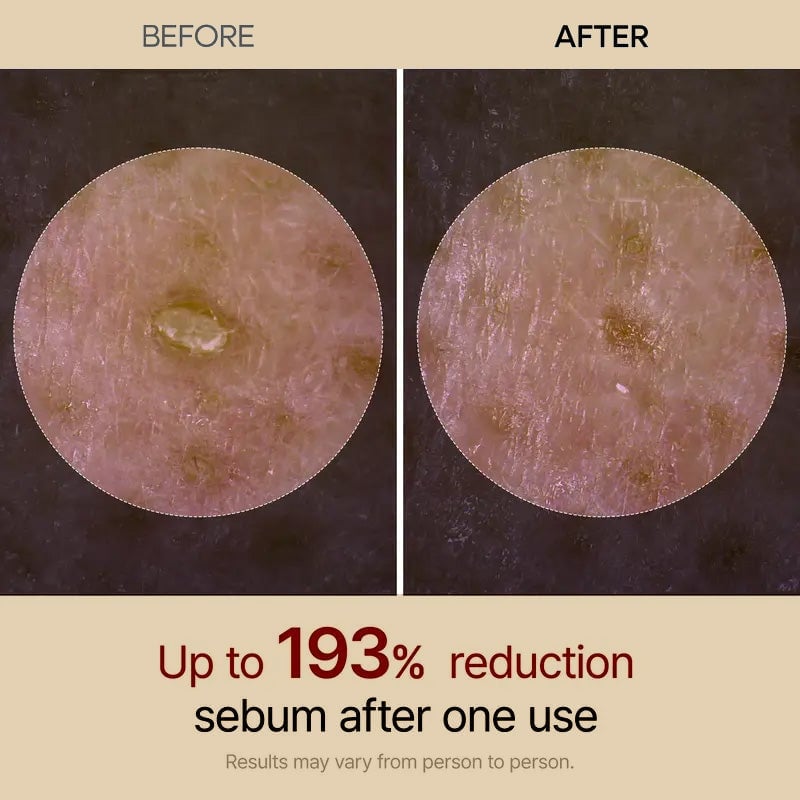 Gentle Exfoliating Ampoule – Black Rice