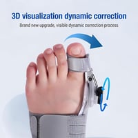 Upgraded Bunion Corrector