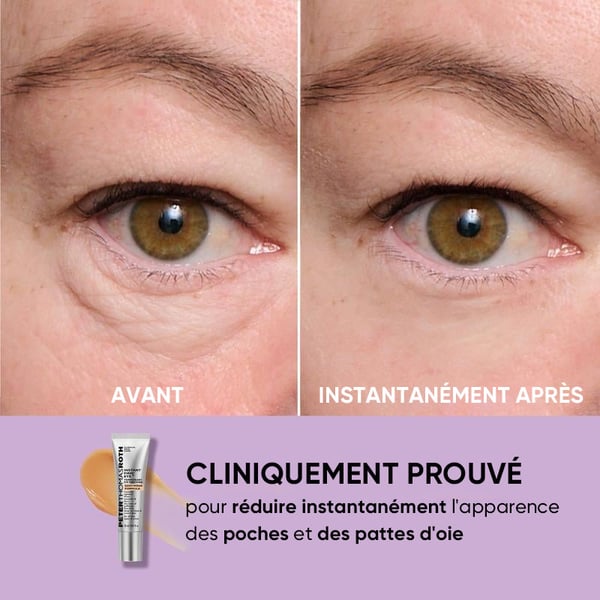 Tenseur temporaire pour les yeux