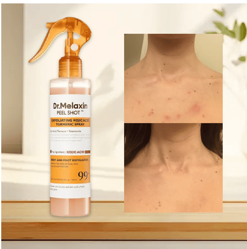 Keratinpleie Kojicsyre Gurkemeiespray