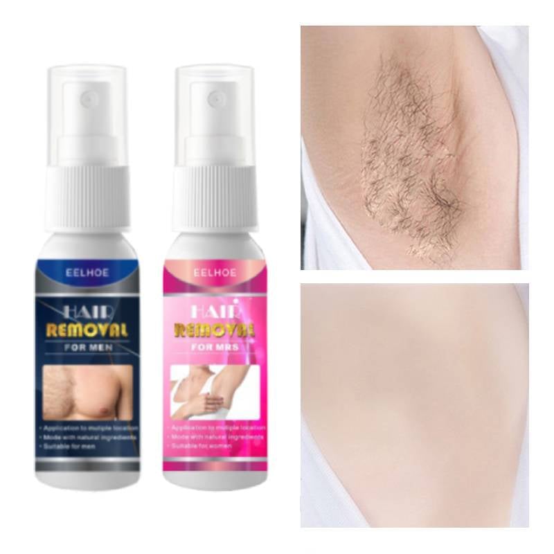 🎉Sommer-Specials🎉Kraftvolles und schmerzfreies Haarentfernungsspray