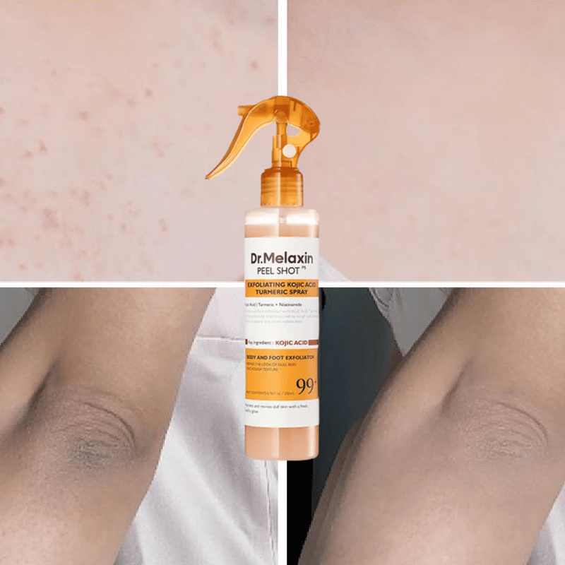 Keratinpleie Kojicsyre Gurkemeiespray