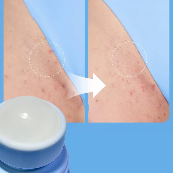 Beruhigende Essenz zur Haarentfernung