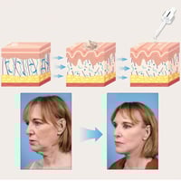 Verstevigend En Hydraterend Essenceserum