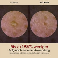Sanfte Peeling-Ampulle